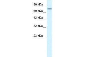 WB Suggested Anti-RIPK1 Antibody Titration:  0. (RIPK1 anticorps  (Middle Region))