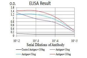 Black line: Control Antigen (100 ng),Purple line: Antigen (10 ng), Blue line: Antigen (50 ng), Red line:Antigen (100 ng)
