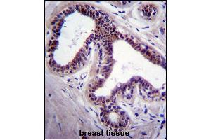 PK8 Antibody (C-term) (ABIN391724 and ABIN2841613) immunohistochemistry analysis in forlin fixed and paraffin embedded hun breast tissue followed by peroxidase conjugation of the secondary antibody and DAB staining. (JNK anticorps  (C-Term))