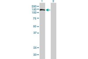 Western Blot analysis of TMEM1 expression in transfected 293T cell line by TMEM1 monoclonal antibody (M01), clone 5B4. (TRAPPC10 anticorps  (AA 1162-1257))