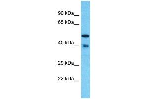 Western Blotting (WB) image for anti-THUMP Domain Containing 1 (THUMPD1) (C-Term) antibody (ABIN2774581) (THUMPD1 anticorps  (C-Term))