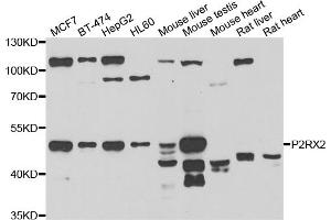 Western blot analysis of extracts of various cell lines, using P2RX2 antibody (ABIN5975474) at 1/1000 dilution. (P2RX2 anticorps)