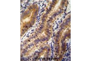 ANGPT2 antibody (C-term) immunohistochemistry analysis in formalin fixed and paraffin embedded human uterus tissue followed by peroxidase conjugation of the secondary antibody and DAB staining.