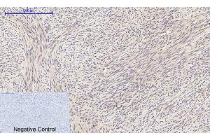 Immunohistochemical analysis of paraffin-embedded human uterus tissue.