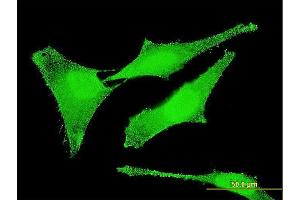 Immunofluorescence of monoclonal antibody to SET on HeLa cell.