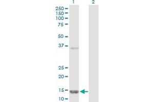 Western Blot analysis of FABP5 expression in transfected 293T cell line by FABP5 MaxPab polyclonal antibody. (FABP5 anticorps  (AA 1-135))