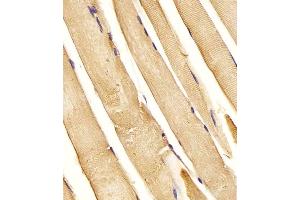 (ABIN6243629 and ABIN6577994) staining CHST1 in Human skeletal muscle tissue sections by Immunohistochemistry (IHC-P - paraformaldehyde-fixed, paraffin-embedded sections).
