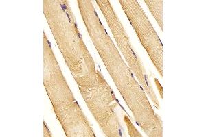 (ABIN6243629 and ABIN6577994) staining CHST1 in Human skeletal muscle tissue sections by Immunohistochemistry (IHC-P - paraformaldehyde-fixed, paraffin-embedded sections). (CHST1 anticorps  (C-Term))