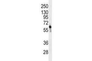 Western blot analysis of PFKFB3 antibody and CEM lysate