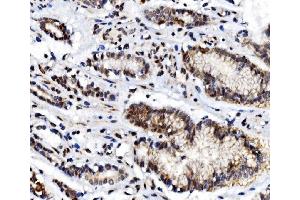 IHC analysis of NR3C1 using anti-NR3C1 antibody (ABIN3043453).