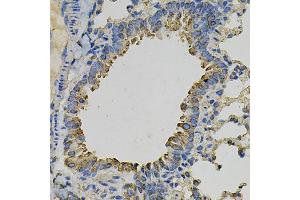 Immunohistochemistry of paraffin-embedded mouse lung using PSAT1 Antibody (ABIN6293473) at dilution of 1:100 (40x lens). (PSAT1 anticorps)