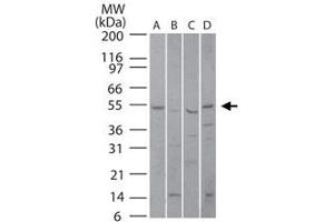 Western blot analysis of PIAS4 in (A) human liver, (B) mouse liver, (C) rat liver and (D) human Jurkat lysate using PIAS4 polyclonal antibody  at 5 ug/mL . (PIAS4 anticorps  (AA 46-60))