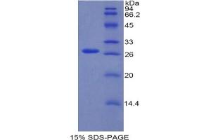 SDS-PAGE analysis of Mouse RUNX2 Protein. (RUNX2 Protéine)
