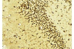 ABIN6268870 at 1/100 staining Mouse brain tissue by IHC-P.