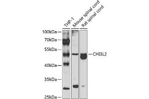 Western blot analysis of extracts of various cell lines, using CHI3L2 antibody (ABIN6132056, ABIN6138529, ABIN6138530 and ABIN6223574) at 1:1000 dilution. (CHI3L2 anticorps  (AA 27-390))