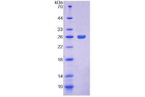 SDS-PAGE analysis of Mouse COASY Protein. (COASY Protéine)