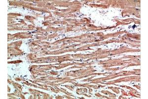 Immunohistochemical analysis of paraffin-embedded human-heart, antibody was diluted at 1:200
