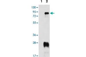 Western blot analysis of PRMT7 (arrow) using PRMT7 polyclonal antibody . (PRMT7 anticorps  (N-Term))