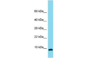 Host: Rabbit Target Name: C12orf75 Sample Type: NCI-H226 Whole Cell lysates Antibody Dilution: 1. (OCC-1 anticorps  (N-Term))