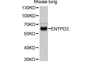 Western blot analysis of extracts of mouse lung, using ENTPD3 antibody (ABIN4903580) at 1:1000 dilution. (ENTPD3 anticorps)