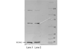 RCAN1 antibody - middle region  validated by WB using MOUSE OSTEOCLASTS at 1:1000. (RCAN1 anticorps  (Middle Region))