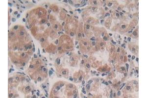DAB staining on IHC-P; Samples: Human Stomach Tissue