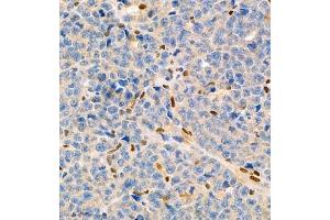 Immunohistochemistry of paraffin embedded mouse myeloma using MNDA (ABIN7074709) at dilution of 1:2000 (400x lens) (MNDA anticorps)