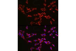 anti-Ribosomal Protein L13 (RPL13) antibody