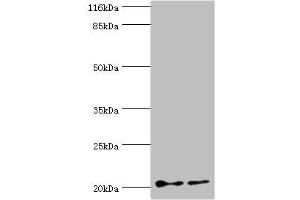 Western blot All lanes: UBE2C antibody at 2 μg/mL Lane 1: Hela whole cell lysate Lane 2: U87 whole cell lysate Secondary Goat polyclonal to rabbit IgG at 1/10000 dilution Predicted band size: 20, 16, 17, 18 kDa Observed band size: 20 kDa (UBE2C anticorps  (AA 2-179))