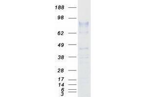 Validation with Western Blot