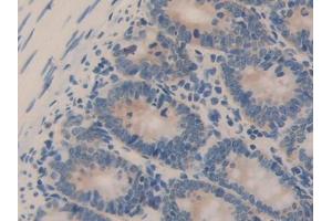 DAB staining on IHC-P; Samples: Rat Small intestine Tissue