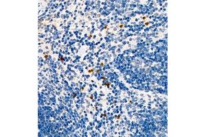 Immunohistochemistry of paraffin embedded mouse spleen using CCL3 (ABIN7073450) at dilution of 1:1000 (400x lens)