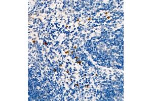 Immunohistochemistry of paraffin embedded mouse spleen using CCL3 (ABIN7073450) at dilution of 1:1000 (400x lens) (CCL3 anticorps)