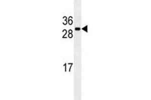 CDCA8 antibody western blot analysis in U251 lysate (CDCA8 anticorps)