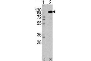 Western blot analysis of FGFR2 antibody and 293 lysate transiently transfected with the human gene. (FGFR2 anticorps  (AA 794-821))