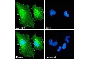 (ABIN570961) Immunofluorescence analysis of paraformaldehyde fixed U251 cells, permeabilized with 0.