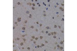 Immunohistochemistry of paraffin-embedded mouse brain using POLR2L antibody (ABIN3023303, ABIN3023304, ABIN3023305 and ABIN6219564) at dilution of 1:200 (40x lens).