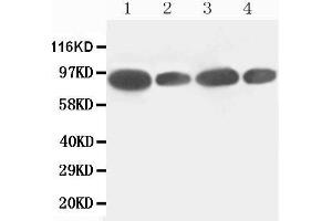 Western Blotting (WB) image for anti-Feline Sarcoma Oncogene (FES) (AA 808-822), (C-Term) antibody (ABIN3043015) (FES anticorps  (C-Term))