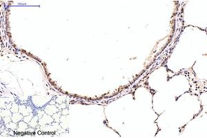 Immunohistochemical analysis of paraffin-embedded rat lung tissue. (NF-kB p65 anticorps)