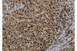 ABIN6262121 and ABIN6277702 at 1/100 staining Human liver tissue by IHC-P. (GSTP1 anticorps  (N-Term))