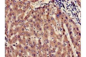 Immunohistochemistry of paraffin-embedded human liver tissue using ABIN7174495 at dilution of 1:100 (UBE2V2 anticorps  (AA 2-145))