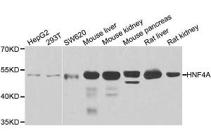 Western blot analysis of extracts of various cell lines, using HNF4A antibody. (HNF4A anticorps  (AA 200-300))