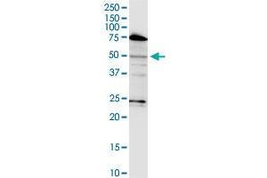 LASS3 monoclonal antibody (M02), clone 6C12. (LASS3 anticorps  (AA 57-134))