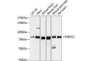 Western blot analysis of extracts of various cell lines, using P antibody (ABIN7269443) at 1:3000 dilution. (PARP12 anticorps  (AA 462-701))