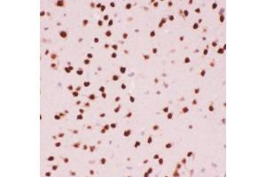 Anti-ATF2 Picoband antibody,  IHC(P): Mouse Brain Tissue