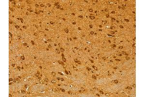 ABIN6262116 and ABIN6273047 at 1/100 staining Mouse brain tissue by IHC-P. (GSTA4 anticorps  (N-Term))