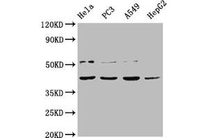Western Blot Positive WB detected in: Hela whole cell lysate, PC-3 whole cell lysate, A549 whole cell lysate, HepG2 whole cell lysate All lanes: DUX4 antibody at 1:2000 Secondary Goat polyclonal to rabbit IgG at 1/50000 dilution Predicted band size: 45 kDa Observed band size: 45 kDa (DUX4 anticorps  (AA 217-402))