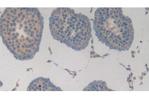 Detection of MMP3 in Rat Testis Tissue using Polyclonal Antibody to Matrix Metalloproteinase 3 (MMP3)