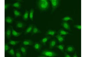 Immunofluorescence analysis of A549 cells using CETN2 antibody.