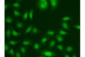 Immunofluorescence analysis of A549 cells using CETN2 antibody.